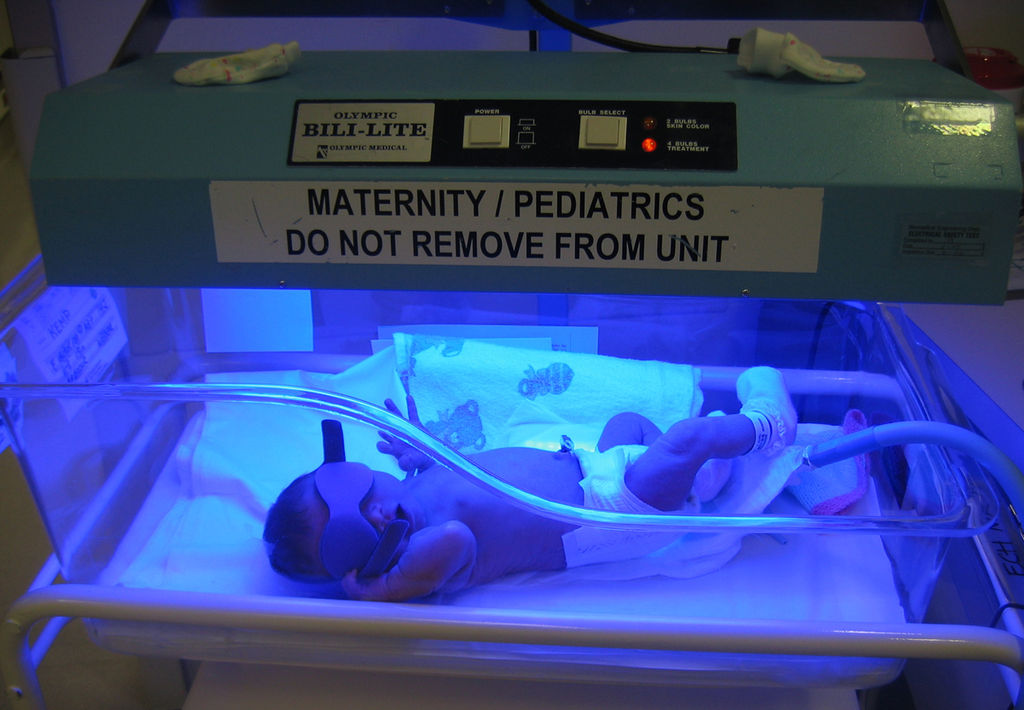 Newborn jaundice treatment with blue light phototherapy